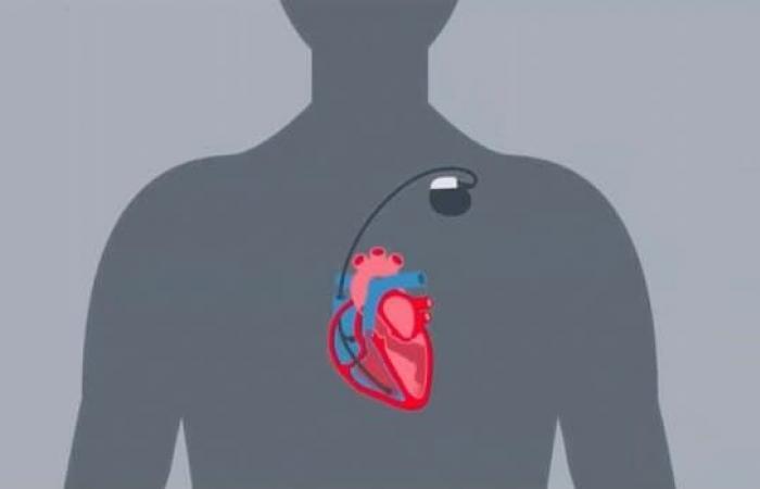 مراهقة من مونتريال  تحصل على تقنية  جديدة لمراقبة القلب
