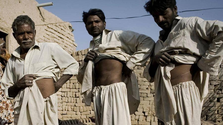 قصص مأساوية من "مناجم بيع الكلى" في أفغانستان