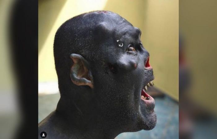 رجل يزيل أنفه ويشم جسمه بالكامل ويزرع قروناً ليتشبه بالأوراك