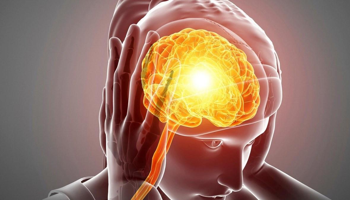آلام الرأس والشقيقة... كيف نميّز بين النوعين؟​
