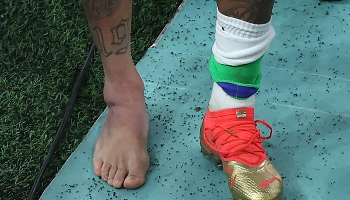 مدرب البرازيل يتحدّث عن إصابة نيمار... هل انتهى مشواره المونديالي؟