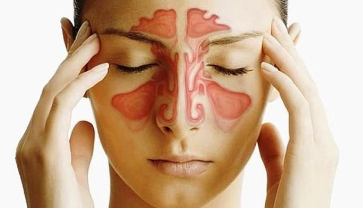 التهاب الجيوب الأنفية قابل للمعالجة بشروط
