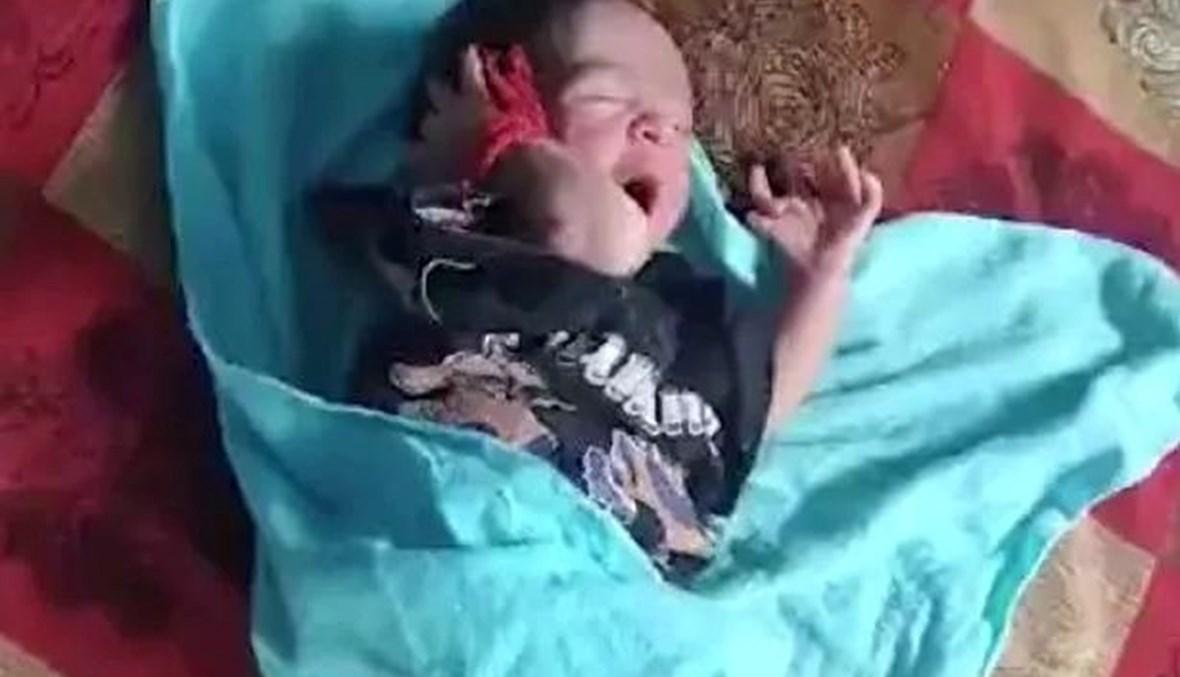 ولادة طفلة بـ26 إصبعاً! (صور)