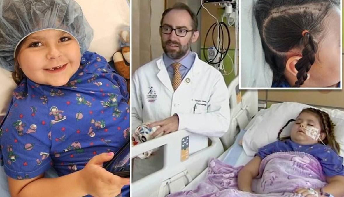 أطباء يفصلون نصف دماغ طفلة مدى الحياة لإنقاذها من مرض عصبي نادر