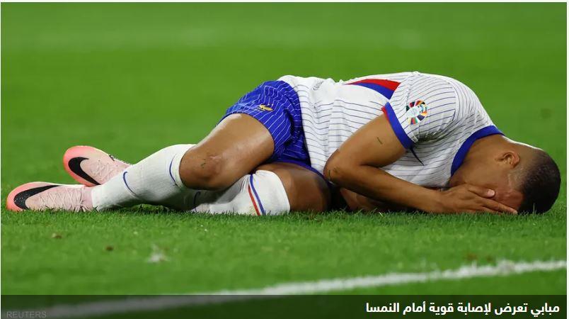 "أنف مبابي".. آخر تحديث من منتخب فرنسا عن الإصابة المقلقة