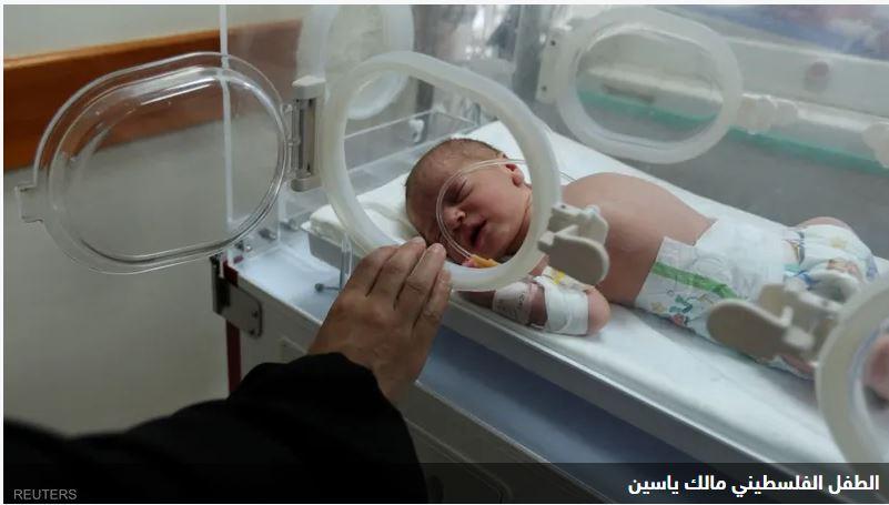 الطفل "المعجزة".. رضيع فلسطيني يخرج حيا من رحم أمه المتوفاة