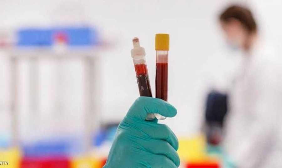 عداد كورونا يعاود الارتفاع.. 29 إصابة جديدة ووفاة واحدة