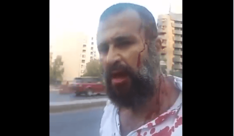 اعتداء "مبرح" على الناشط واصف الحركة.. وفهمي مستنكرا: التحقيق بدأ وقفة تضامنيّة في الأشرفية ودعوة للتجمع أمام قصر العدل غدًا.. ومواقف شاجبة