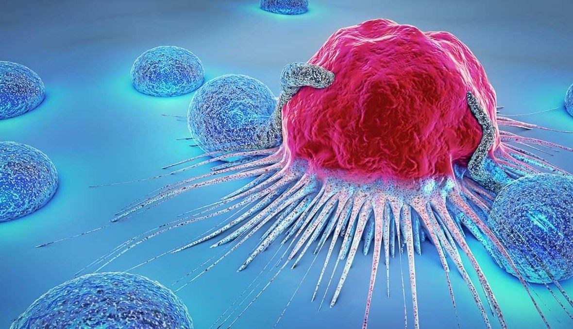 التجارب السريريّة على لقاح علاجي لسرطان الرئة حقّقت نتائج إيجابيّة